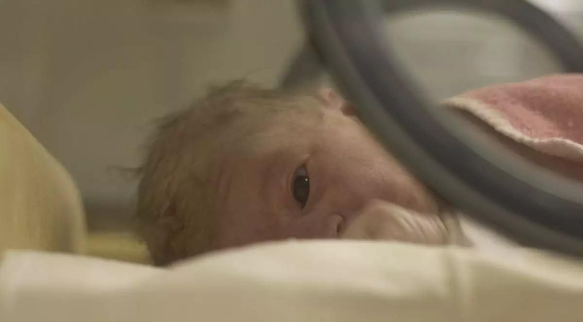 CAZ ULUITOR în CAPITLĂ! GEMENE născute în ANI DIFERIȚI