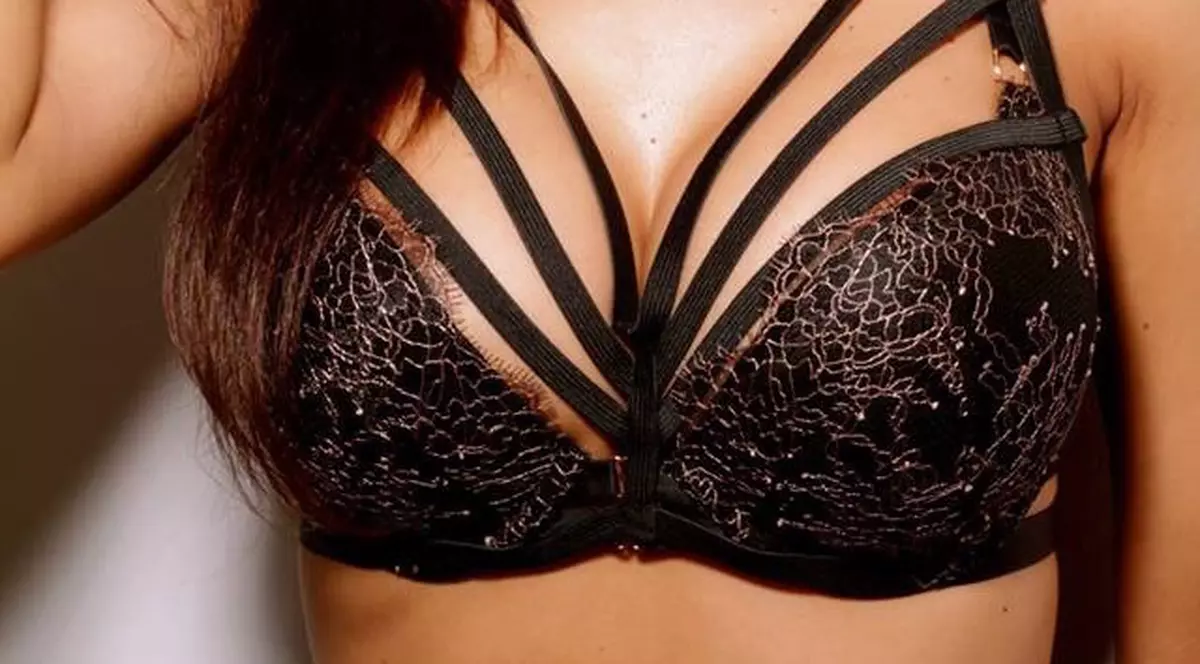 CUM ARATĂ o vedetă de la noi, la o săptămână după operația la nas | FOTO ÎN ARTICOL