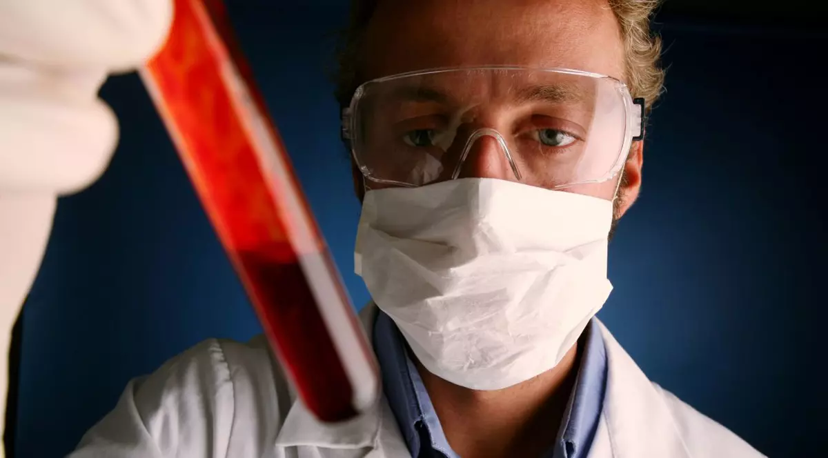 Cine a fost primul om infectat cu HIV? Cum a apărut epidemia de SIDA