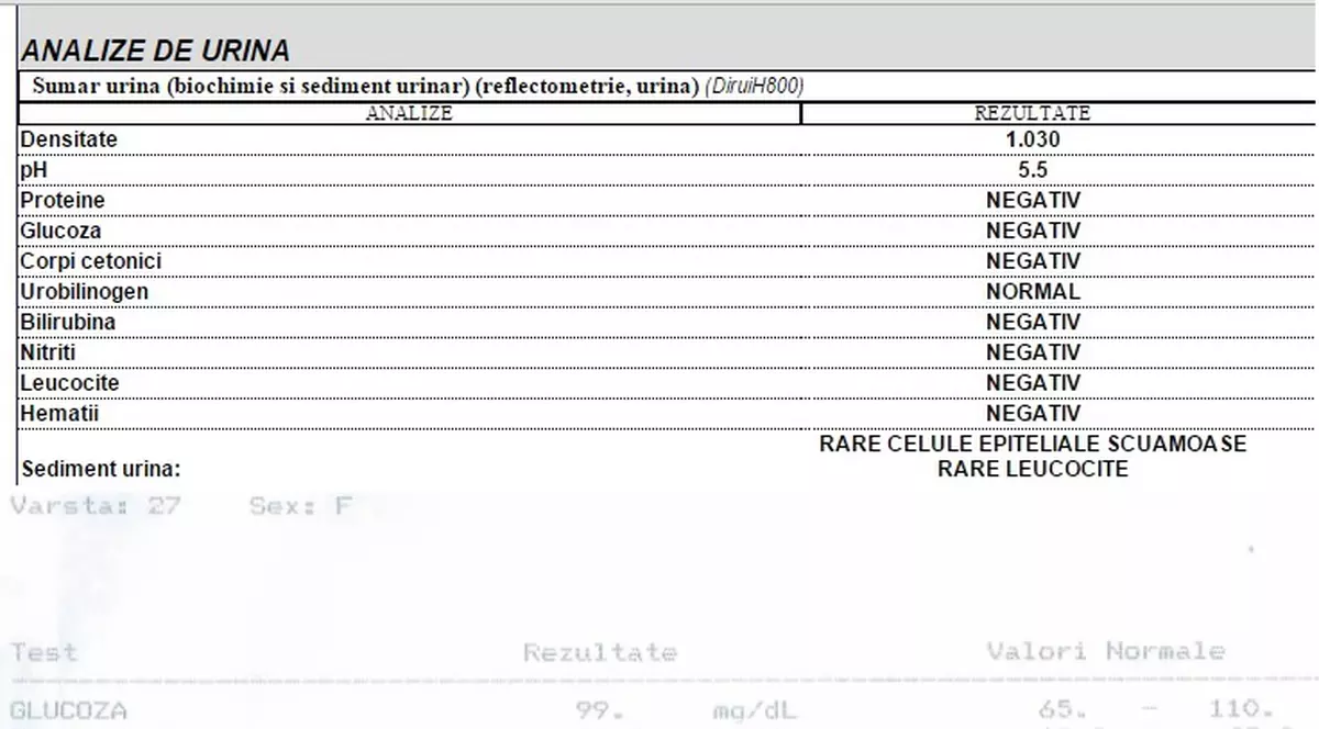 CE SPUNE ANALIZA DE URINĂ DESPRE SĂNĂTATEA TA