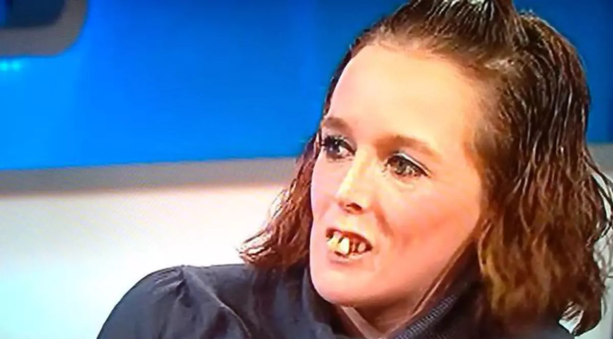 AVEA DINȚII ĂȘTIA, însă s-a TRANSFORMAT TOTAL. VEI RĂMÂNE ULUIT DACĂ vezi cum arată acum?