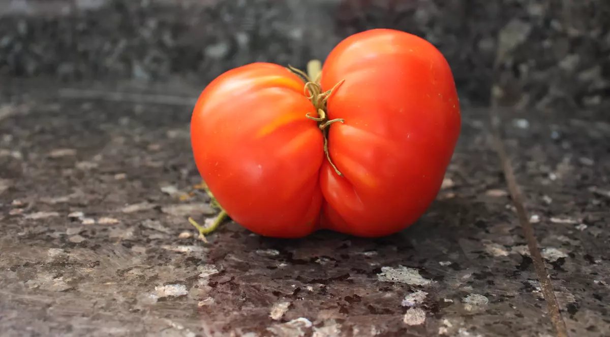 18 lucruri pe care nu le știai despre fundul tău