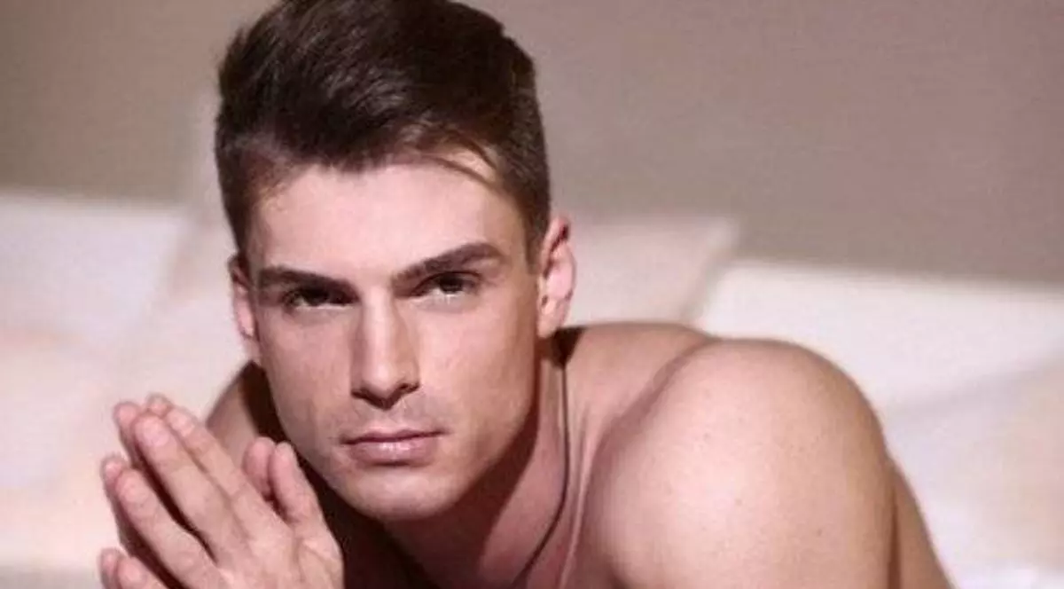 Bogdan Vlădău, de nerecunoscut după implantul de păr