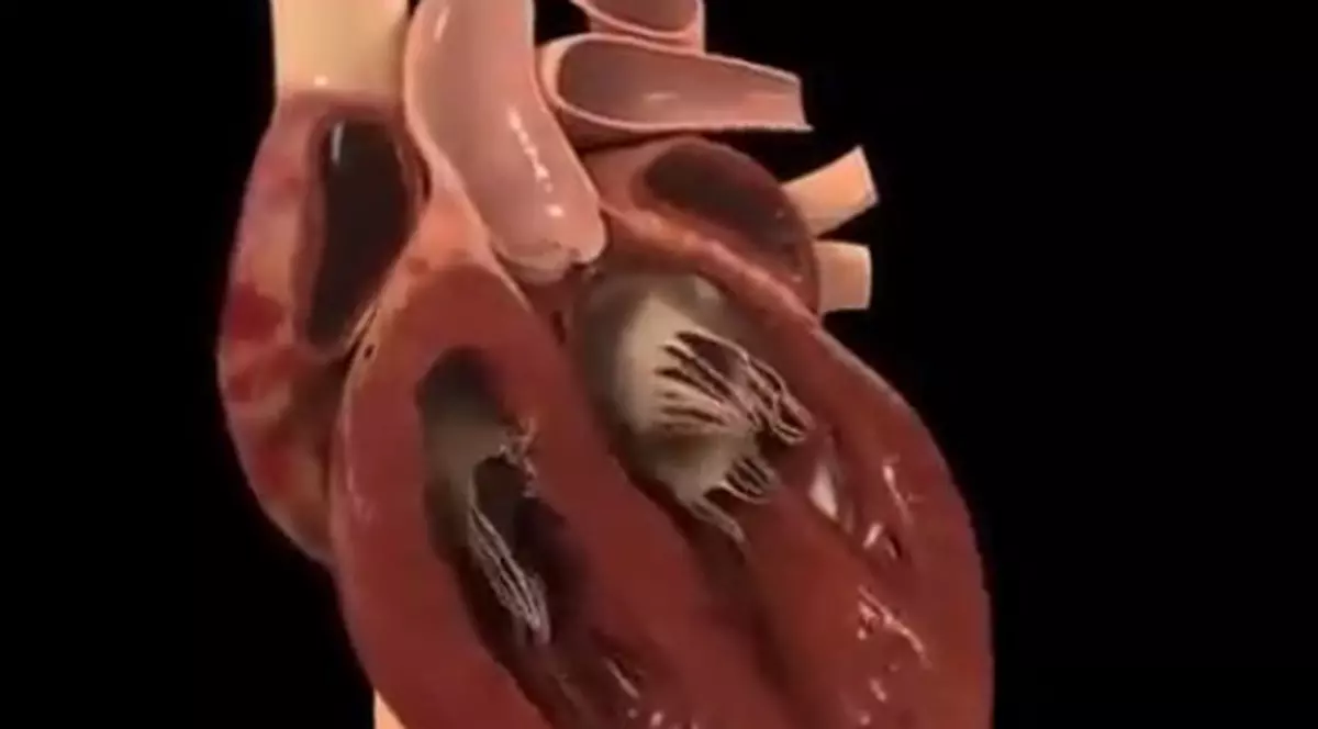 FOARTE TARE! Ce se întâmplă în interiorul unei inimi care bate! VIDEO