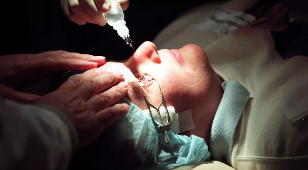 DESCOPERIRE TERIFIANTĂ! Ce au găsit medicii în creierul UNEI FEMEI! "Avea dinți și păr"