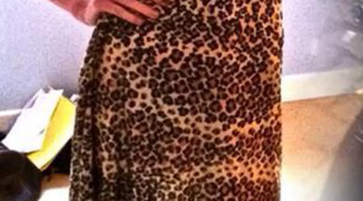 Adolescenta care mânca doar 14 calorii PE ZI a început recuperarea. Vezi ce SCHIMBARE RADICALĂ!