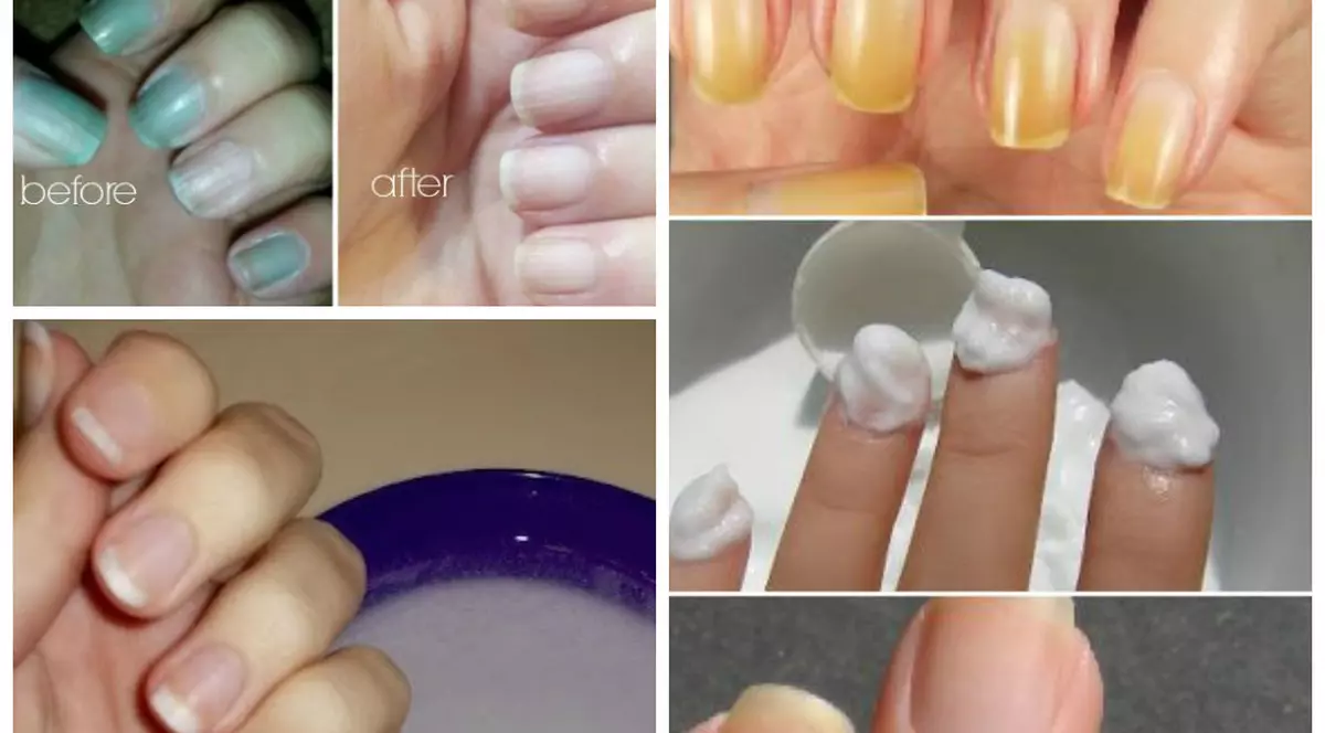 13 MODURI ÎN CARE POȚI FOLOSI APA OXIGENATĂ