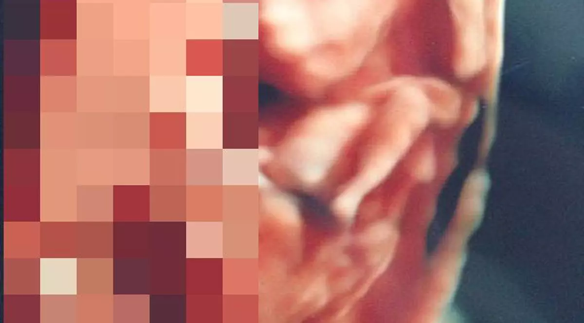 Abia aştepta să vadă prima imagine cu bebeluşul ei, însă a fost ŞOCATĂ atunci când medicul i-a arătat ecografia | FOTO