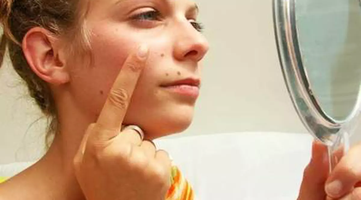 Atenţie la ALUNIȚE! Află cât de PERICULOASE pot fi