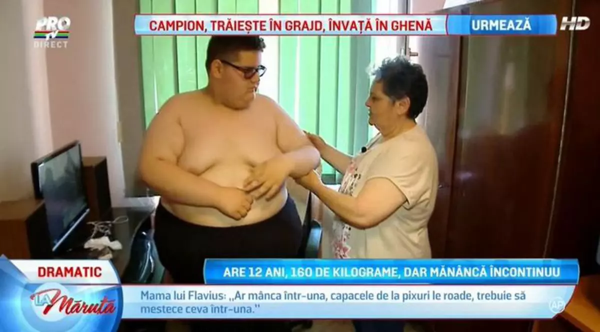 De necrezut! Un băiat de 12 ani din Sibiu cântărește 160 de kilograme