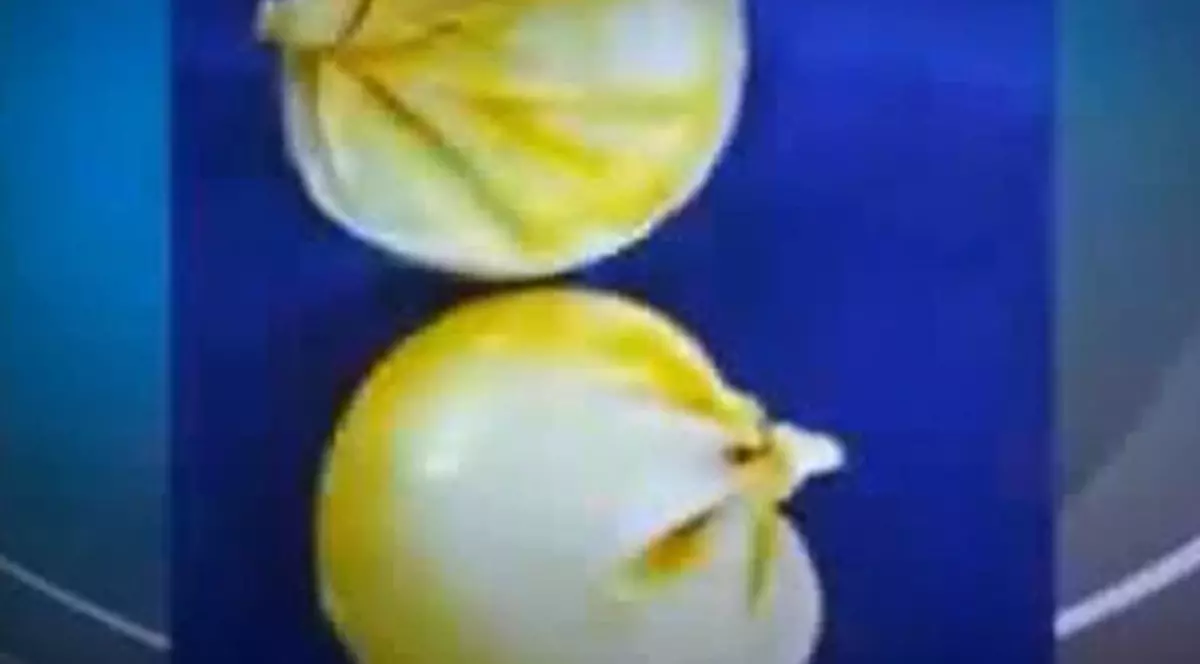 Femeie prinsă pe aeroport cu 1.5 kilograme de cocaină în implanturile mamare | VIDEO