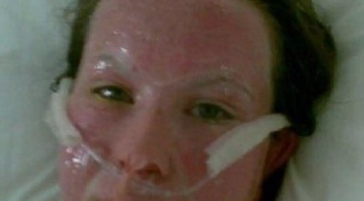 Era comparată cu un monstru la 17 ani, dar acum s-a ”VINDECAT”. Fata asta a suferit O TRANSFORMARE SENZAȚIONALĂ! FOTO