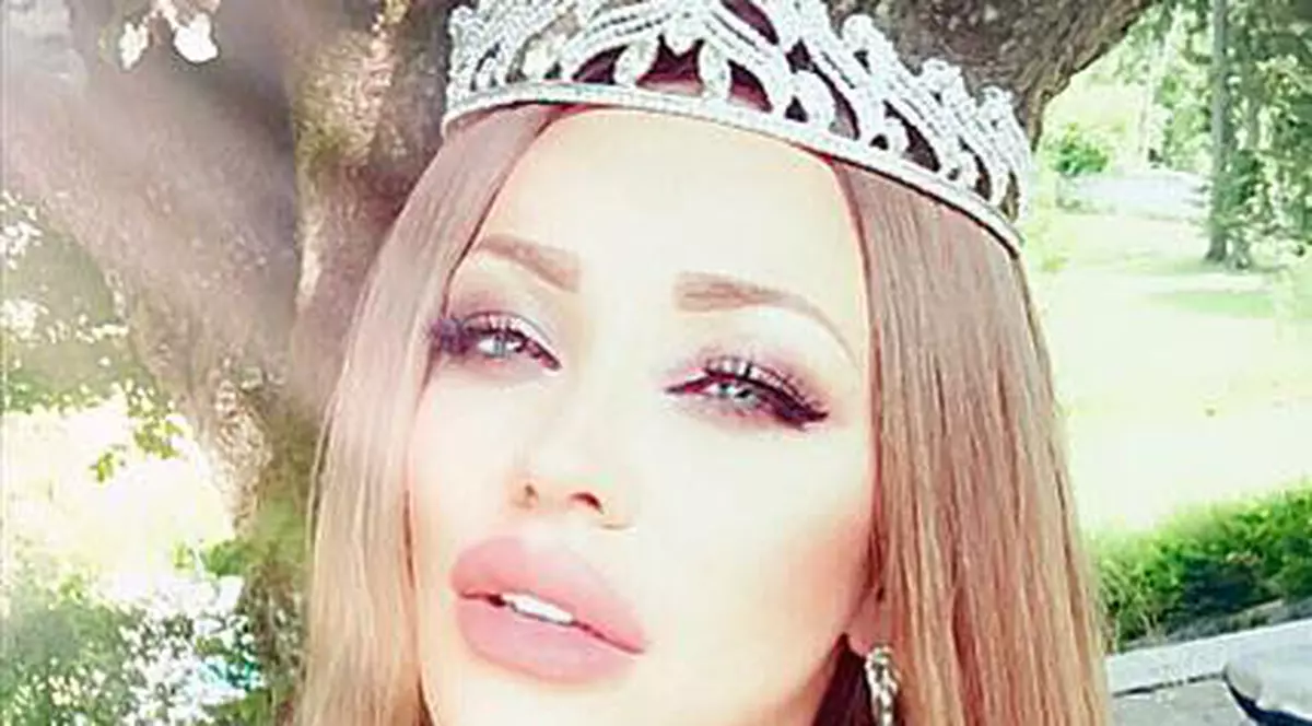 Bianca Drăgușanu, exasperată de buzele prea mari! "Nu știu cum să scap de ele"