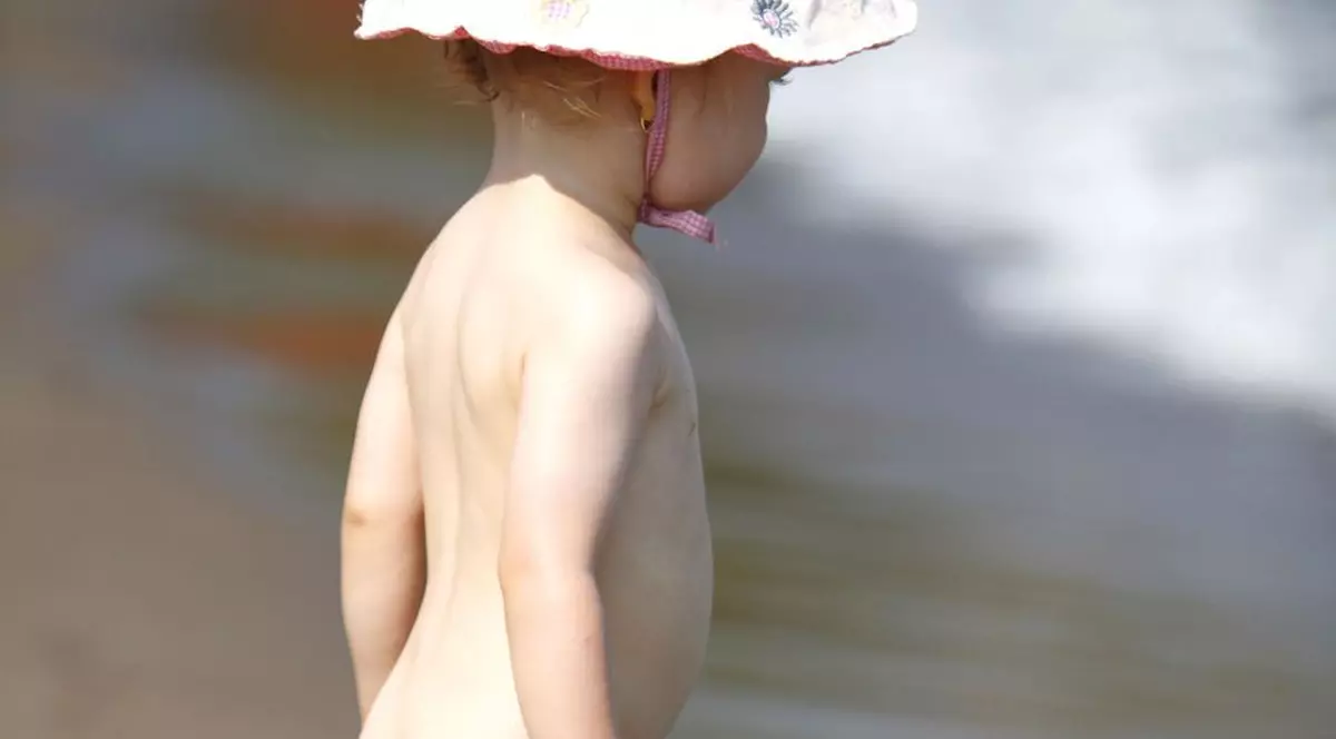 Medicii avertizează: Copiii sub trei ani nu trebuie expuși la soare
