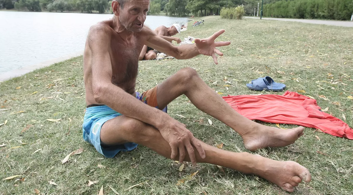 EXCLUSIV | Carol Haidu, la un pas să‑și piardă un picior