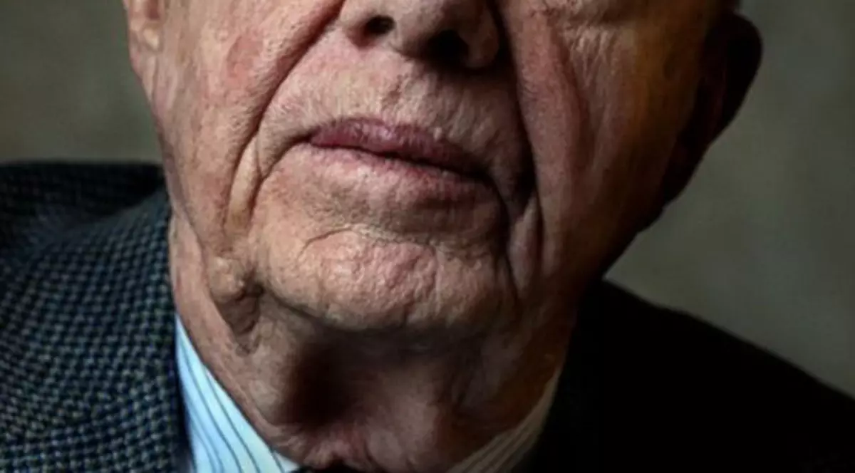 Un fost preşedinte american, diagnosticat cu CANCER LA FICAT