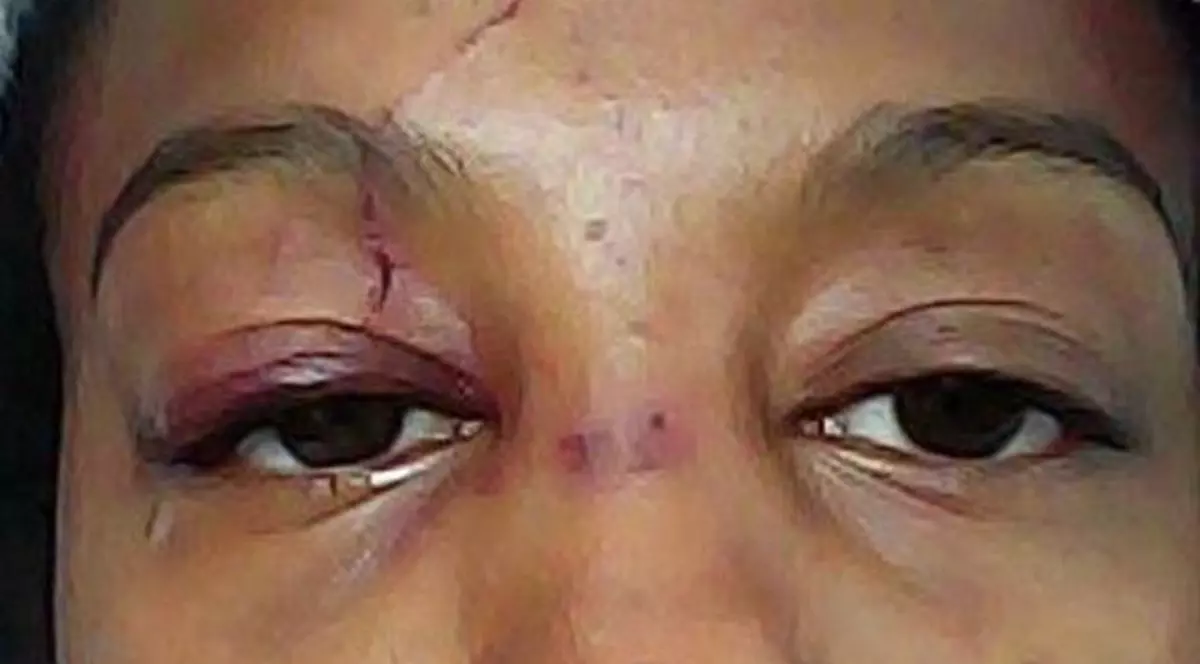 O femeie susţine că a fost bătută pentru că e "prea frumoasă". Cum arată tânăra atacată în plină stradă