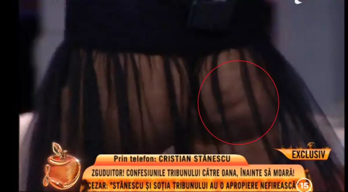 Oana, ce te faci cu celulita? Zăvoranca, cu fundul și celulita la vedere | FOTO