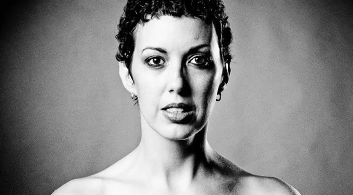 Femei mutilate de cancer la sân. Află poveştile lor!