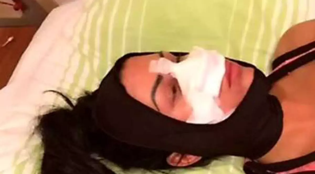 Ce se întâmplă cu Daniela Crudu la o săptămână după ce şi-a operat nasul! Când revine pe micile ecrane!