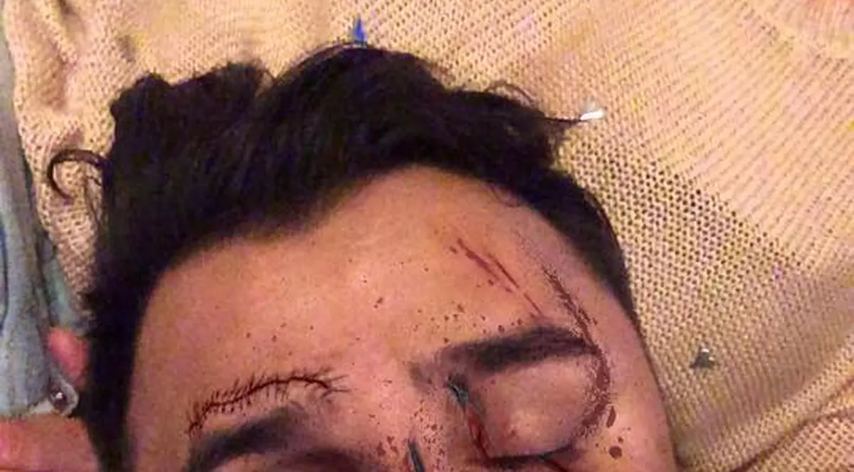 Liviu Guță, bătut crunt! Toate cunoștințele sale sunt îngrozite