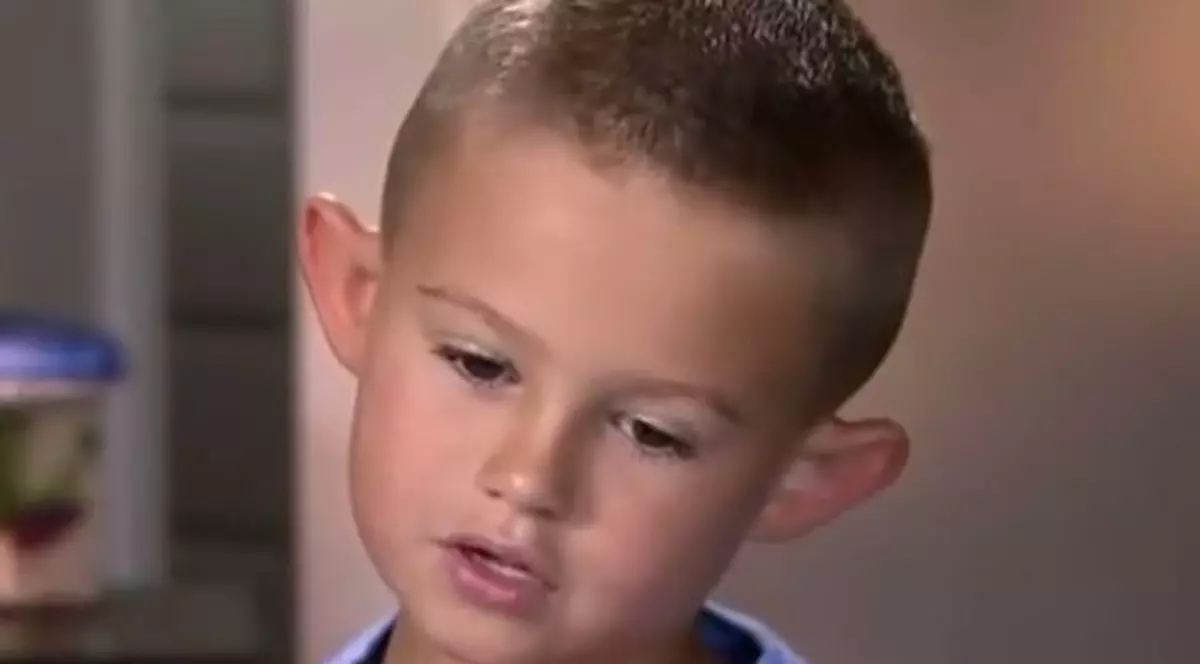 Băieţelul pe care toţi colegii îl strigau "urechi de elf" a fost operat. Cum arată în prezent | VIDEO 