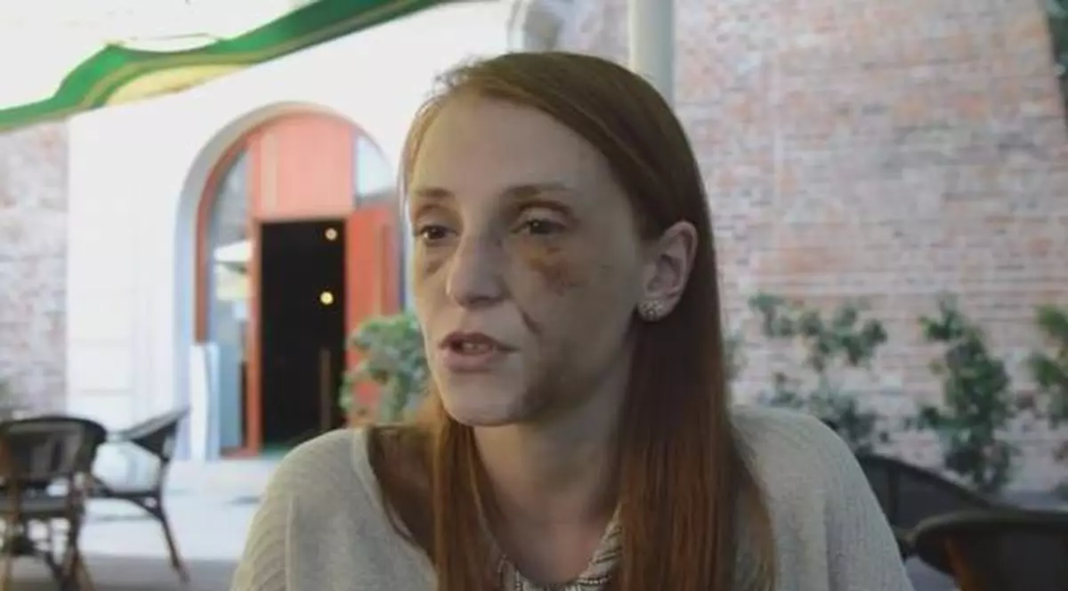 Câţi bani vrea tânăra bătută timp de 22 de ore de la bărbatul care a desfigurat-o