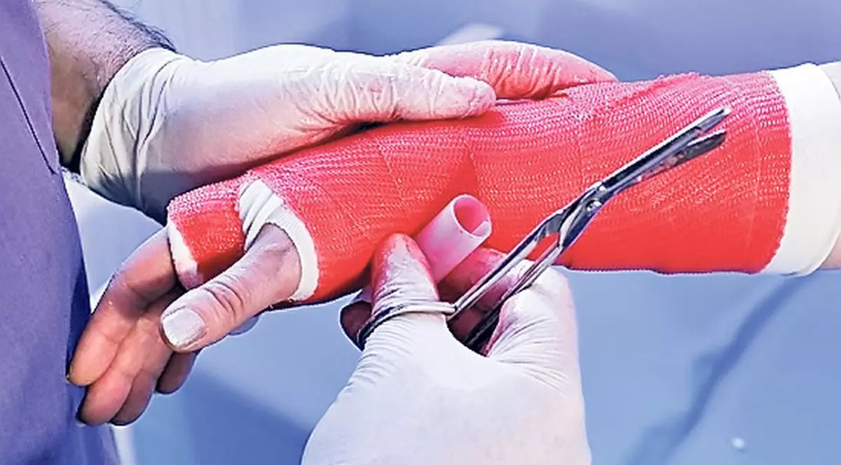 Împodobeşte, doctore, ghipsul! Ghinioniştii cu fracturi de Sărbători îşi pot asorta pansamentul cu bradul