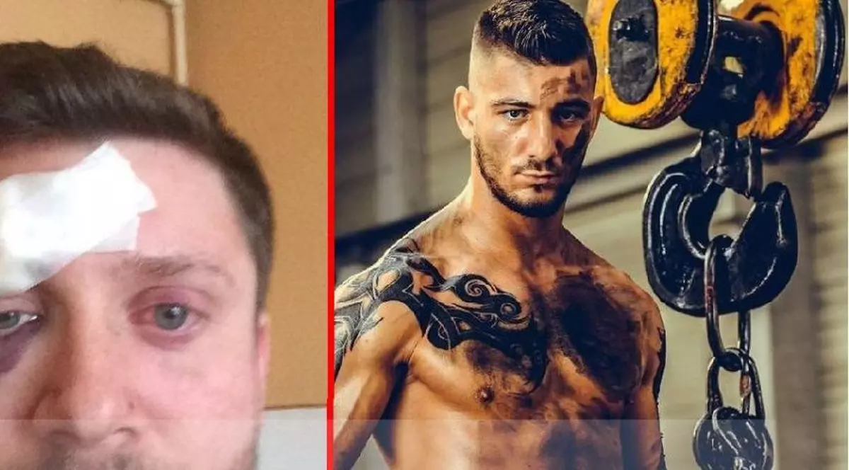 Doi sibieni spun că au fost bătuţi, fără motiv, de un luptător de MMA