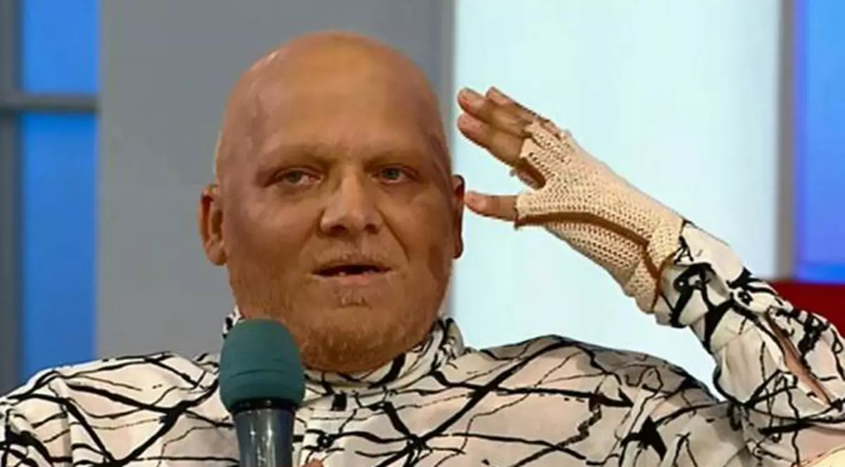 Cea mai proastă veste pentru "Stilistul vedetelor". Bolnav de cancer, Marian Dârţă a ajuns în culmea disperării