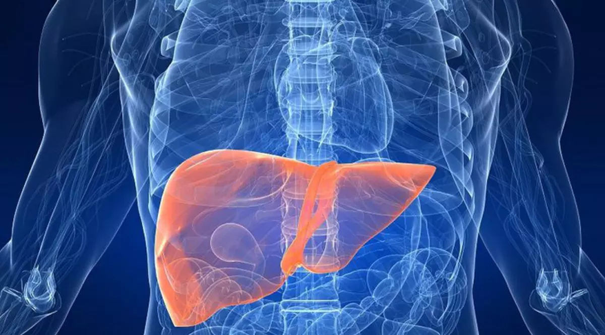 Ciroza hepatică este una dintre cele mai grave boli ale ficatului