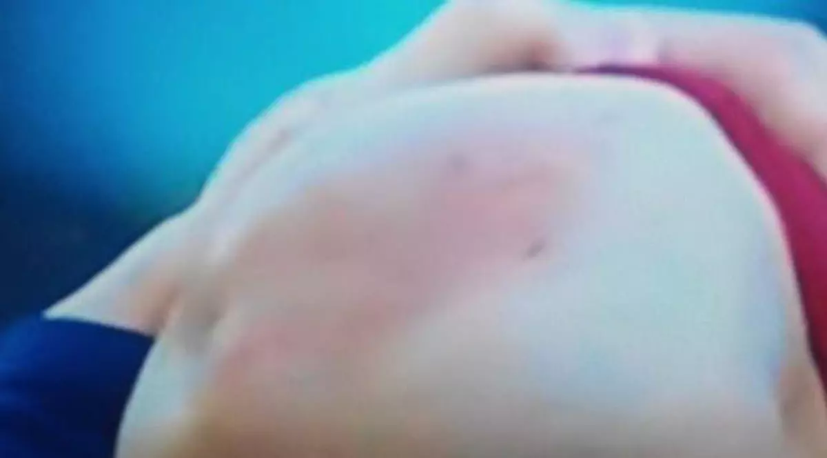 Leo Messi s-a accidentat. ”Puricele” are genunchiul umflat cât un pepene / VIDEO