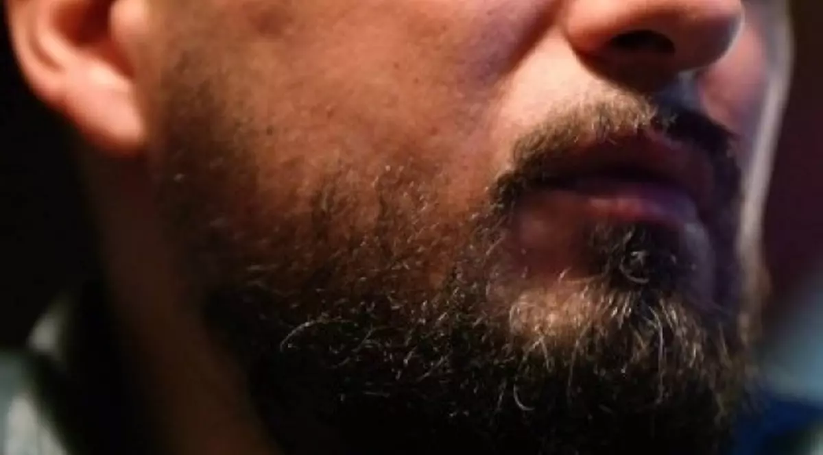 Probleme pentru soţia lui Mumu, unul dintre răniţii de la Colectiv! Ce a păţit în weekend!