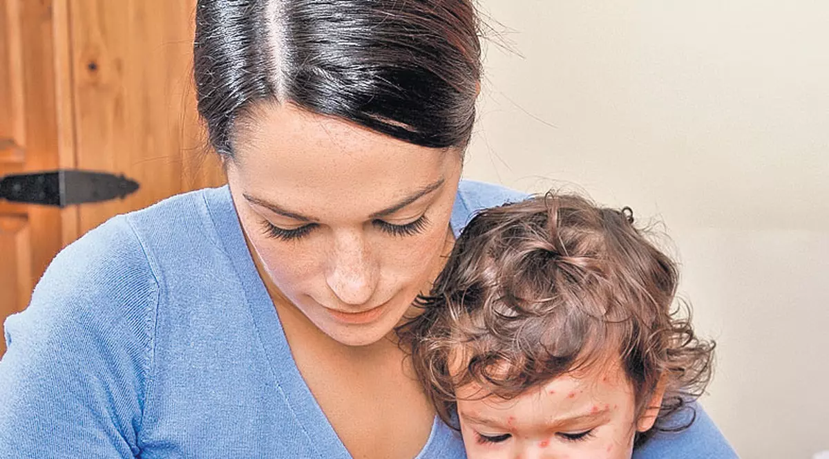 Scarlatina, simptome și tratament. Cum o recunoști de la primele semne