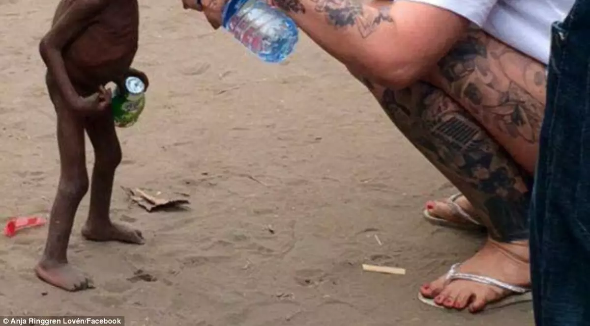 FOTO ȘOCANT: Acest băiețel a fost salvat după ce familia lui l-a lăsat să moară de foame, ciuruit de viermi