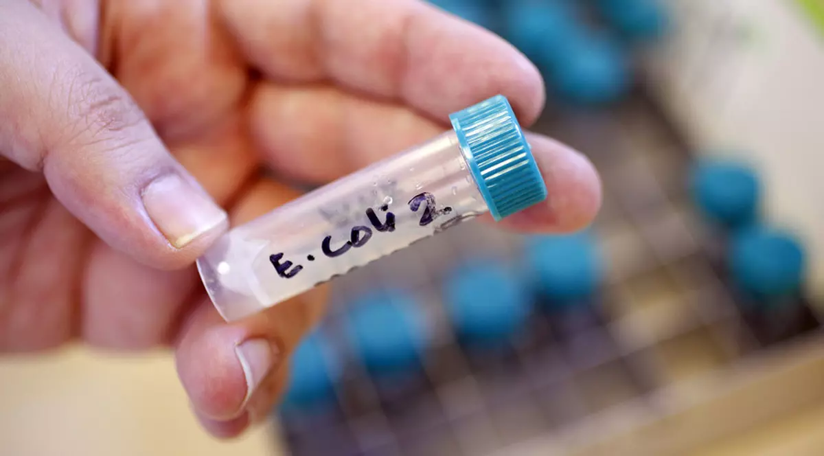 e-coli (1)