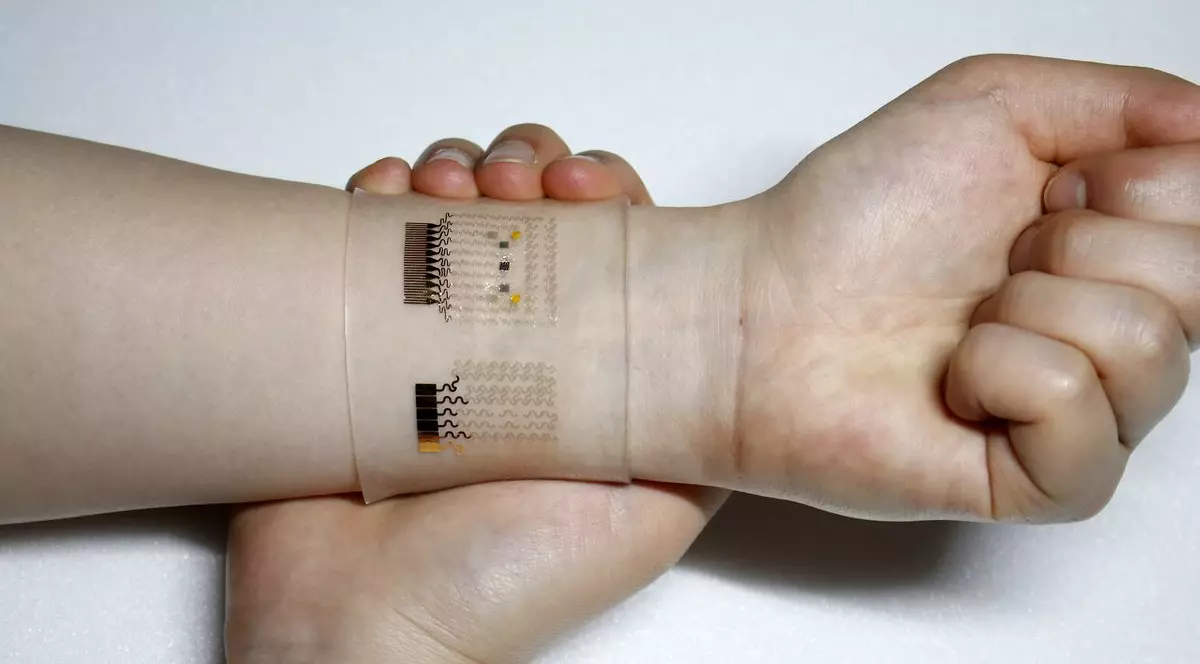 Plasturele inteligent ar putea revoluționa tratamentul diabeticilor