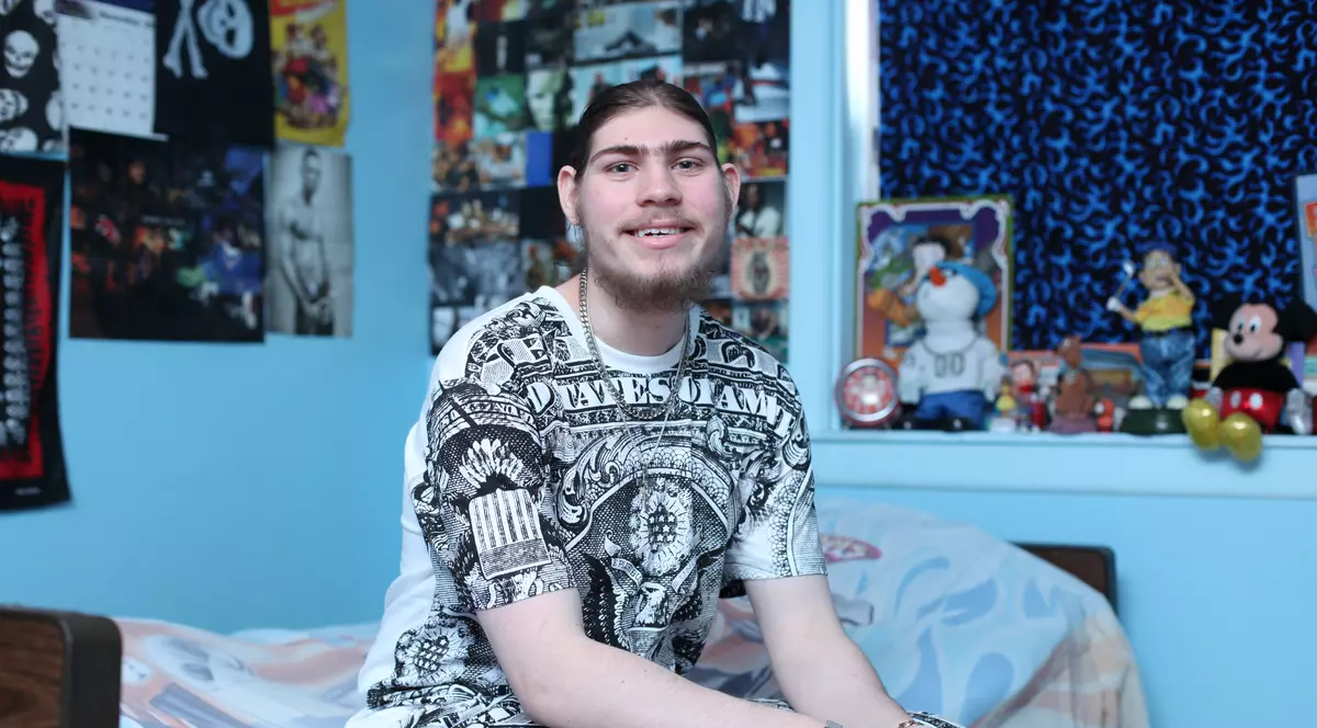 Cum e viața unui tânăr de 19 ani cu microcefalie, boală produsă de virusul Zika!