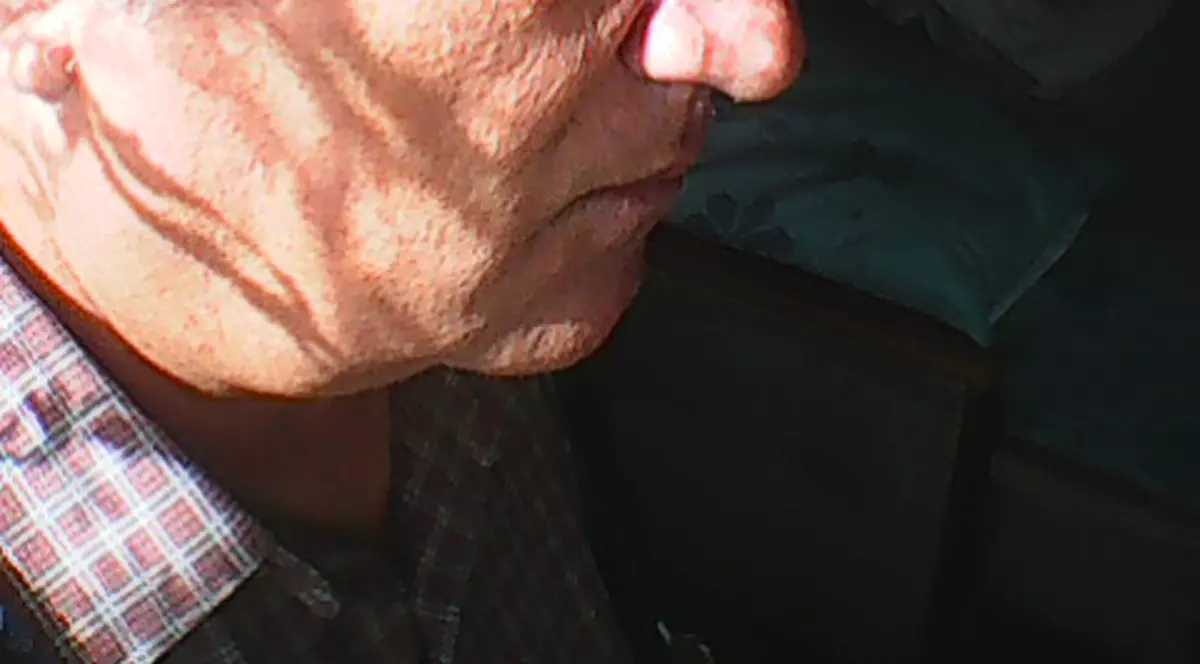 Cazul pacientului Mihai Petre, bătrânul dat afară din spital, înainte de operație, pentru că denunțase un doctor șpăgar