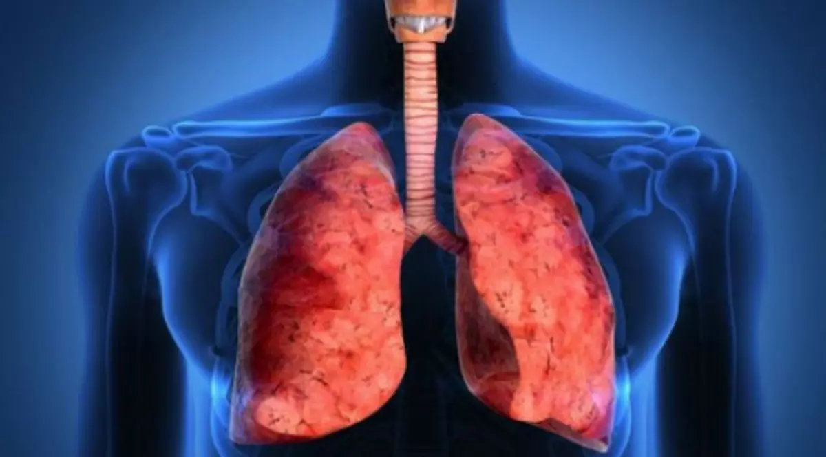 Iată care sunt cele mai bune alimentele care îți curăță plămânii