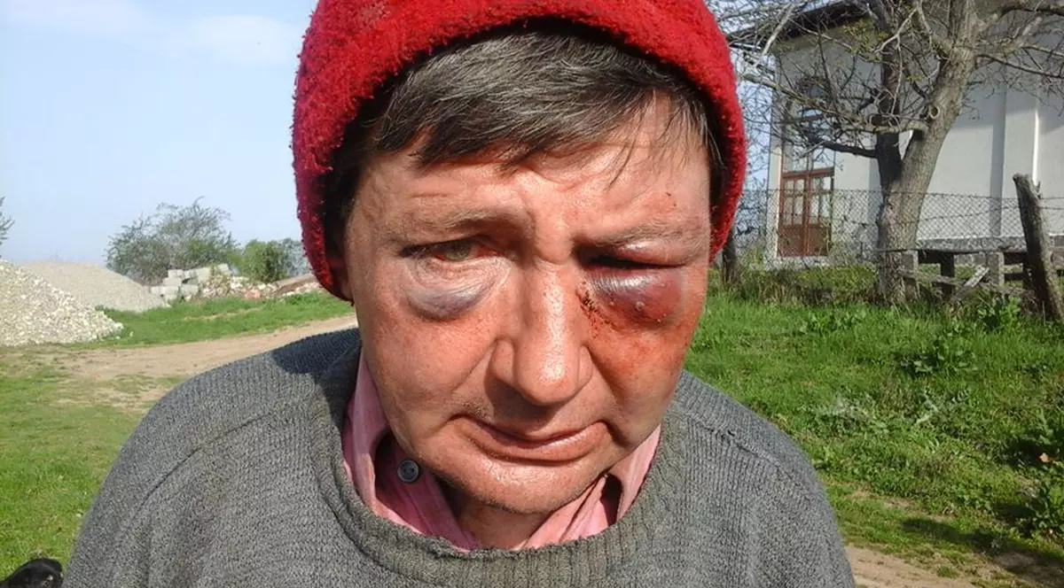 Profesor din Mehedinţi bătut crunt de persoane necunoscute! Au intrat cu toporul peste el în casă!