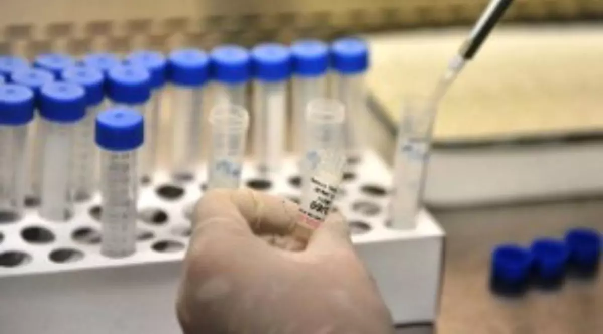 Virusul Zika, transmis pe cale sexuală între doi homosexuali. E primul caz de acest fel