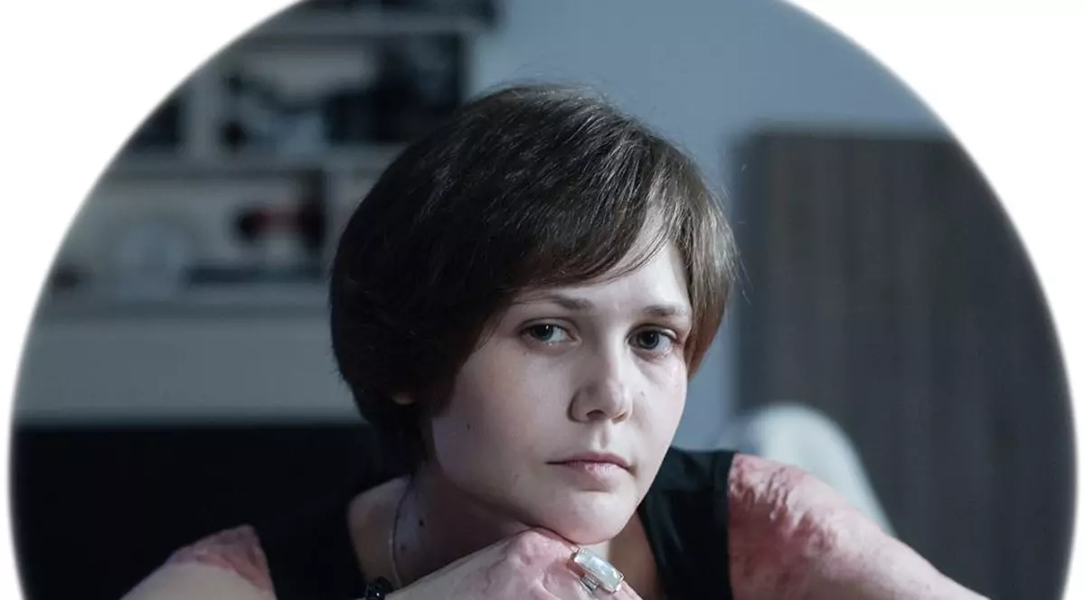 Andrada Mihăilescu, una dintre victimile din Colectiv, învață să își retrăiască viața