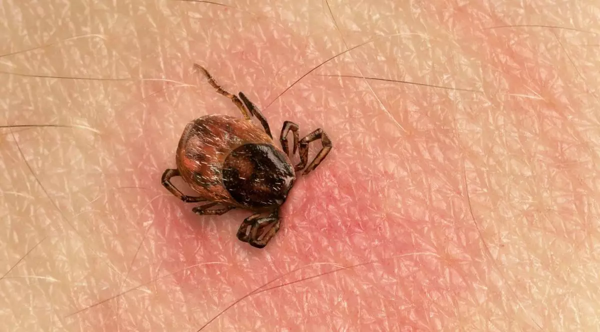 Mușcătura de căpușă - Ce să faci dacă ești mușcat de o căpușă!