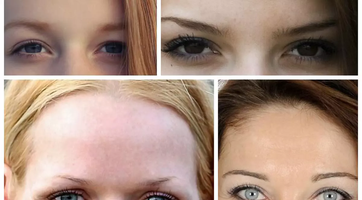 Fruntea înaltă – semn al inteligenței