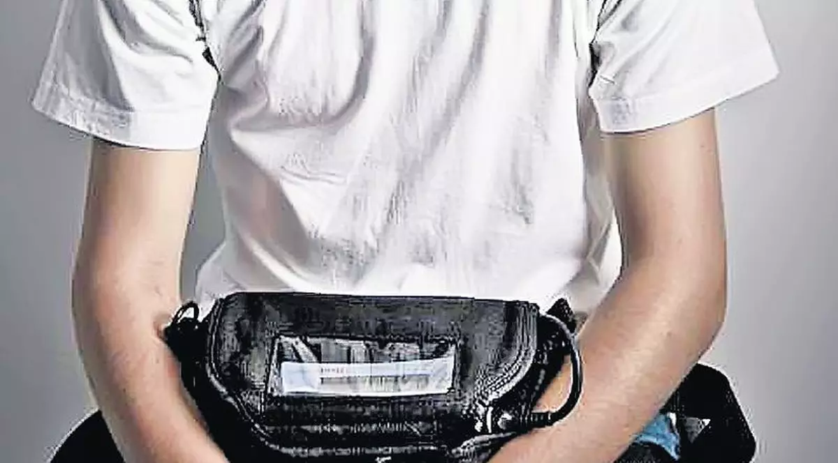 Cazul unic al lui Dumitru Iorga! Băiatul care are inima la brâu, într-o borsetă