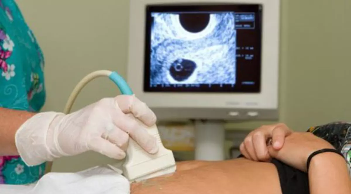 Şocul unei femei însărcinate, când s-a uitat pe prima ecografie. Ce a observat