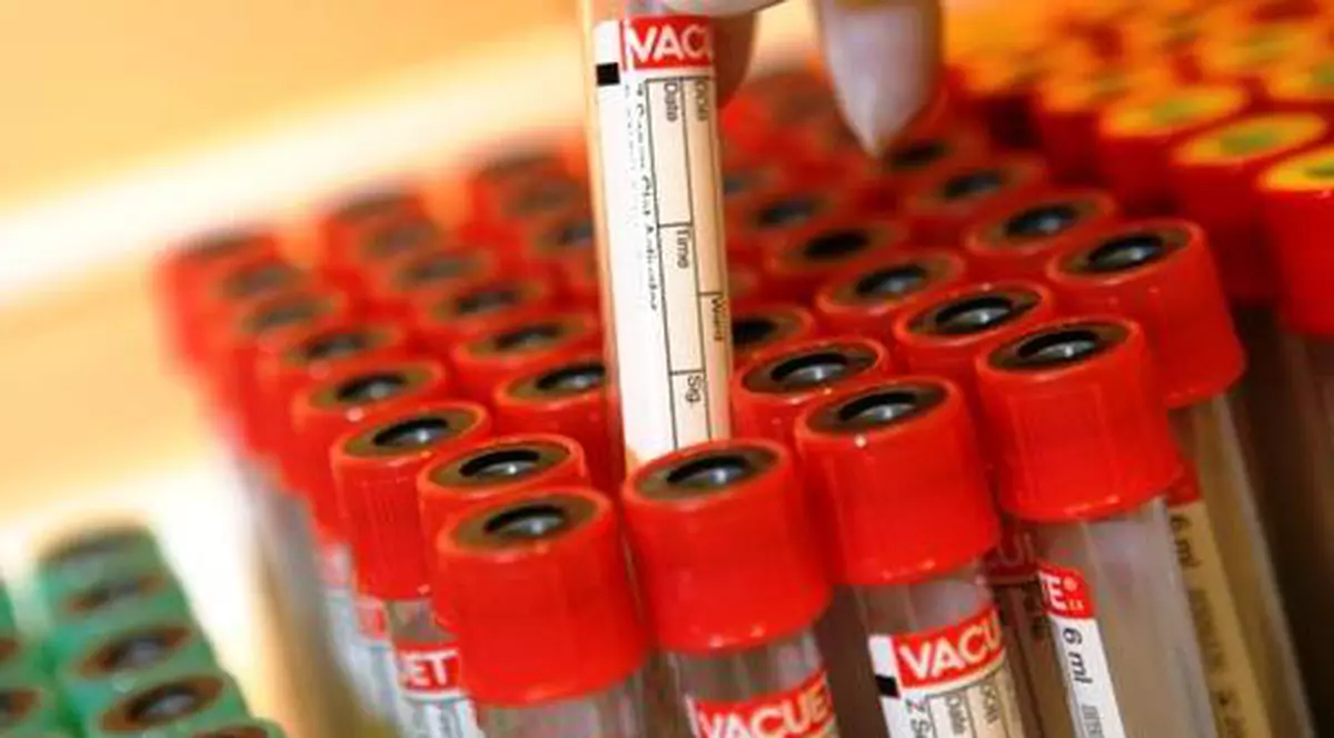 Caz de Antrax, depistat în Giurgiu. Ce măsuri au luat autorităţile