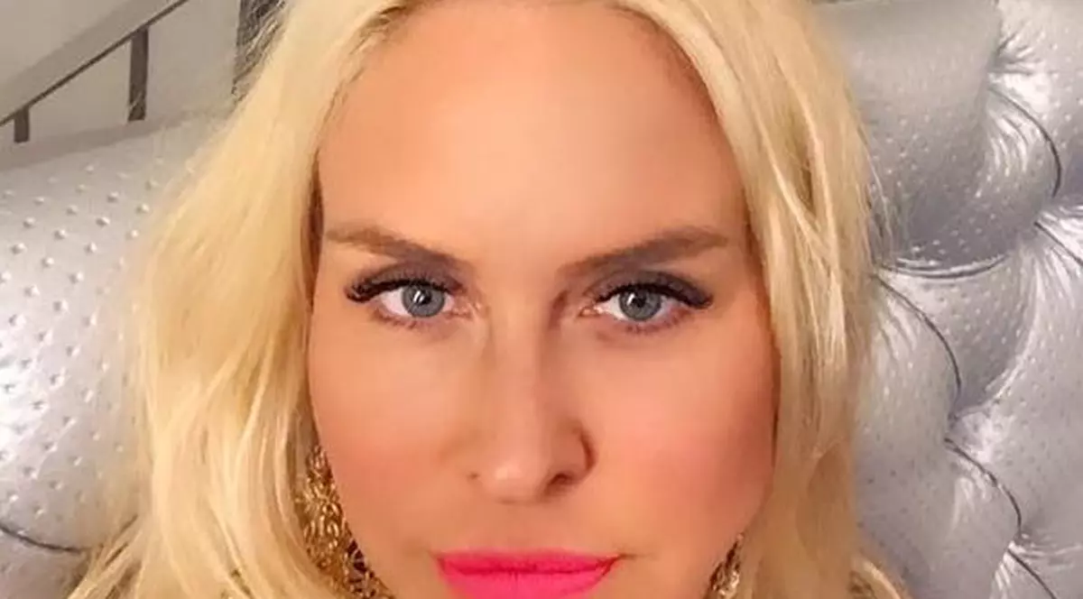 Vica are nas nou. A scapat de bandaje si le-a aratat tuturor cum arata acum