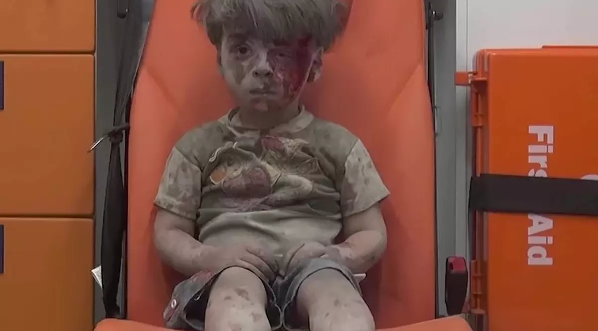 Copilul care a devenit un simbol al războiul din Siria | Mărturii cutremurătoare făcute de doctorii din Alep. “Omran a fost un copil foarte norocos”